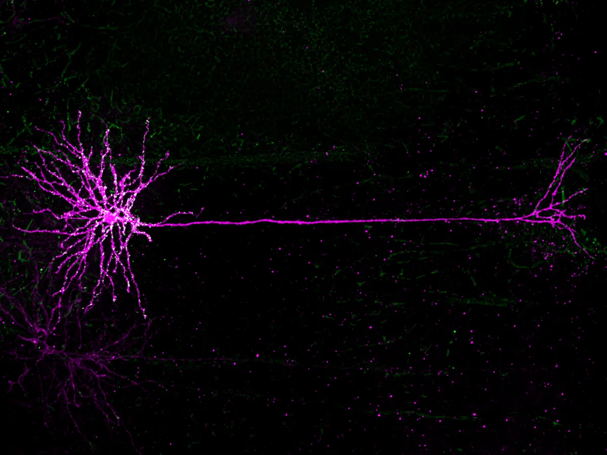 L5 neuron