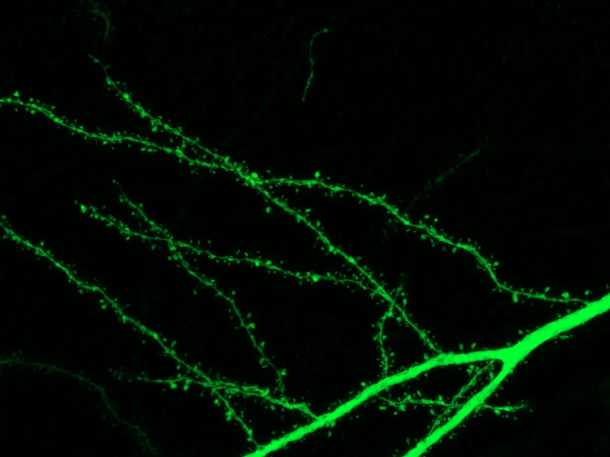 CA1 spines