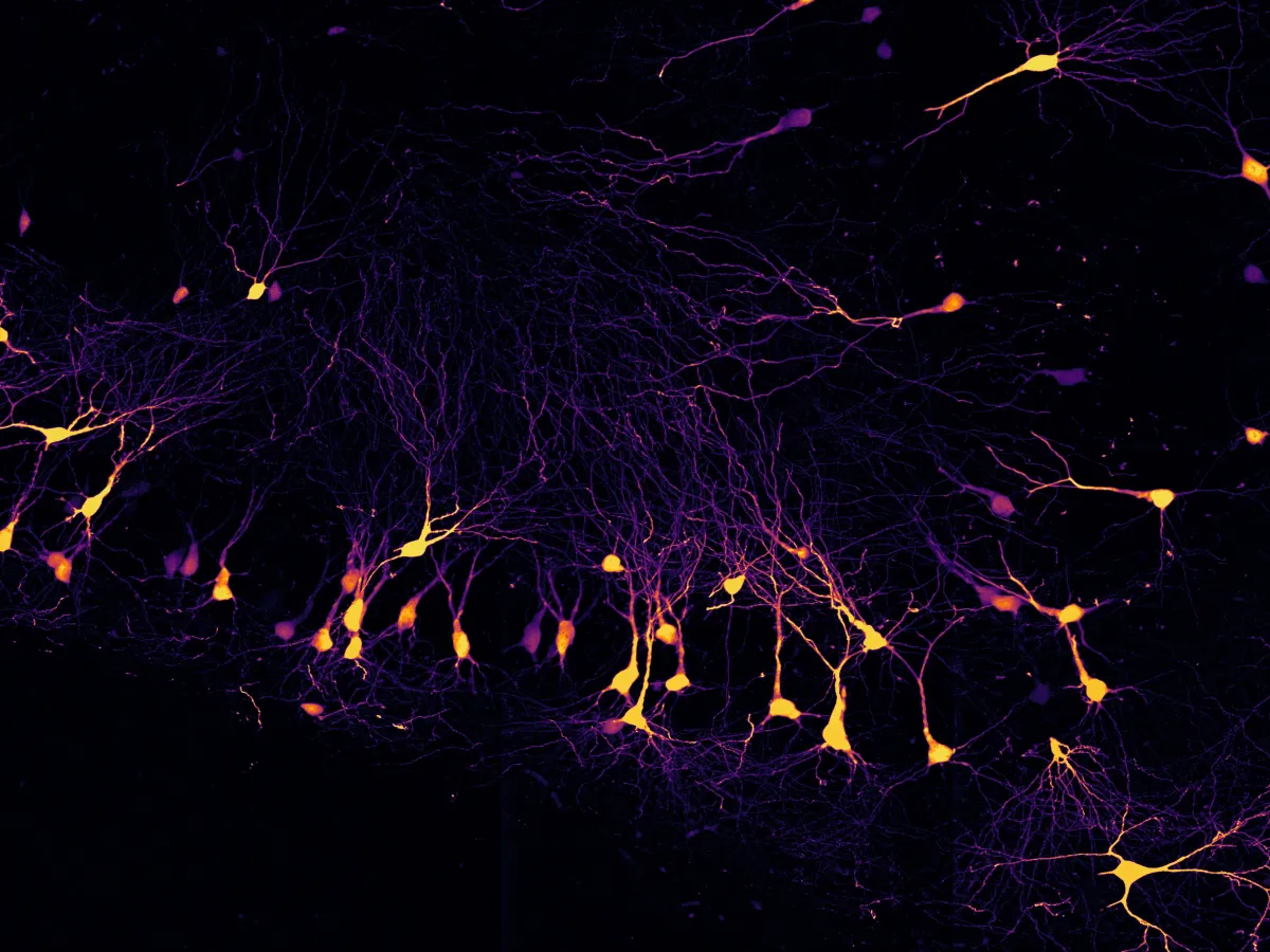 Cell discoverer - CA3 cells
